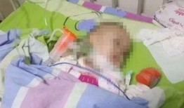 艾滋病毒最新爆料,突破性发现与防控策略